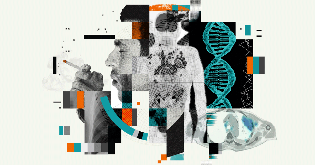  for Siemens Healthliners 